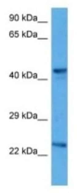 MTERF Rabbit anti-Mouse, Polyclonal, Novus Biologicals:Antibodies:Primary